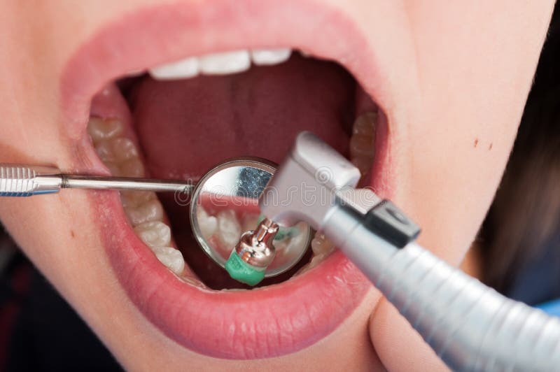 Makro- strzał szczotkuje z dentysty lustrem stomatologiczny profesjonalista zdjęcie stock Makro- strzał szczotkuje z dentysty lustrem stomatologiczny profesjonalista zdjęcie stock