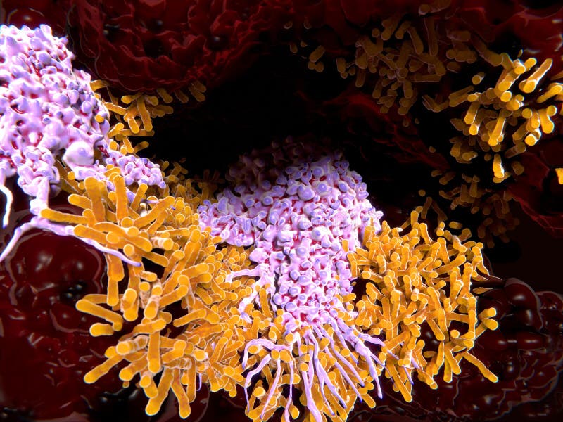 Makrophages που καταπίνει το βάκιλο φυματίωσης στους πνεύμονες στοκ εικόνες με δικαίωμα ελεύθερης χρήσης Makrophages που καταπίνει το βάκιλο φυματίωσης στους πνεύμονες στοκ εικόνες με δικαίωμα ελεύθερης χρήσης