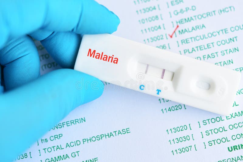 Malaria positive test result stock photos