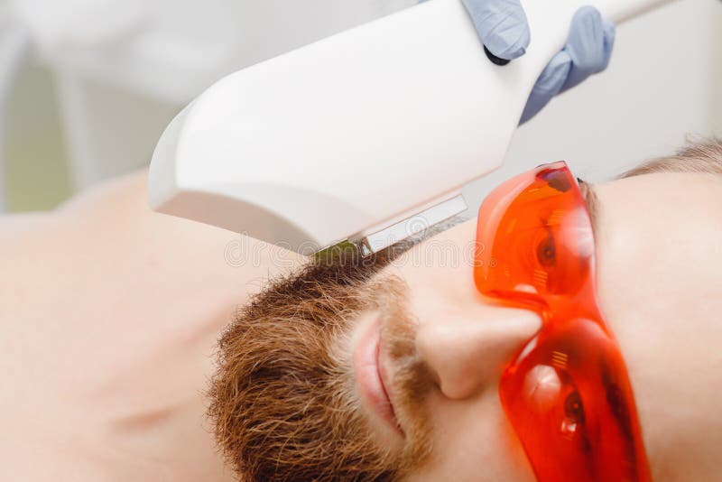Male Depilation Laser Hair Removal Beard and Mustache Procedure Treatment  in Salon. Stock Image - Image of adult, cleaning: 131342243