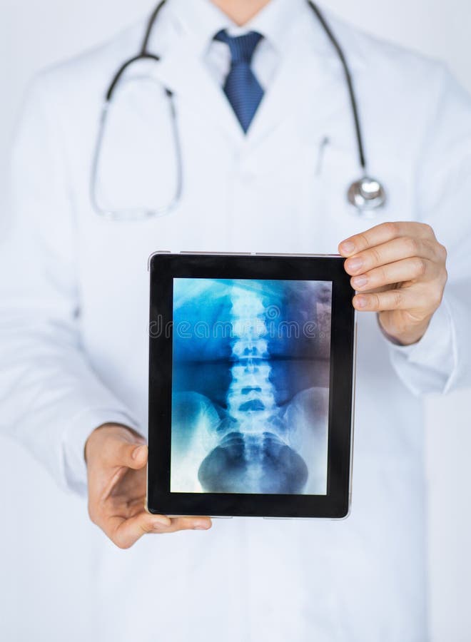 Male doctor holding tablet pc with x-ray royalty free stock photo