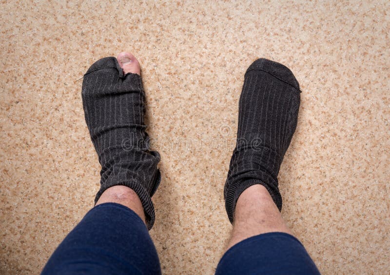 Side view of socks with a hole on the man's legs - Stock Photo