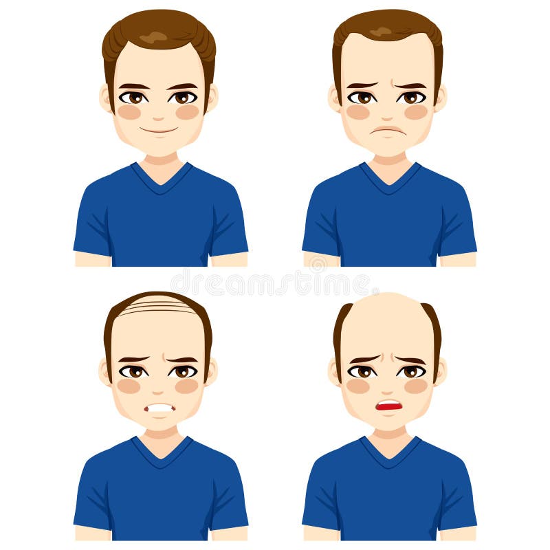 Stages Hair Loss Stock Illustrations – 311 Stages Hair Loss Stock  Illustrations, Vectors & Clipart - Dreamstime
