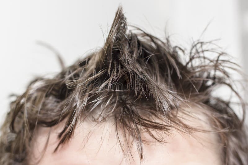 Male Head with Disheveled, Unwashed Hair on a White Background Stock Image  - Image of messy, unwashed: 140608423