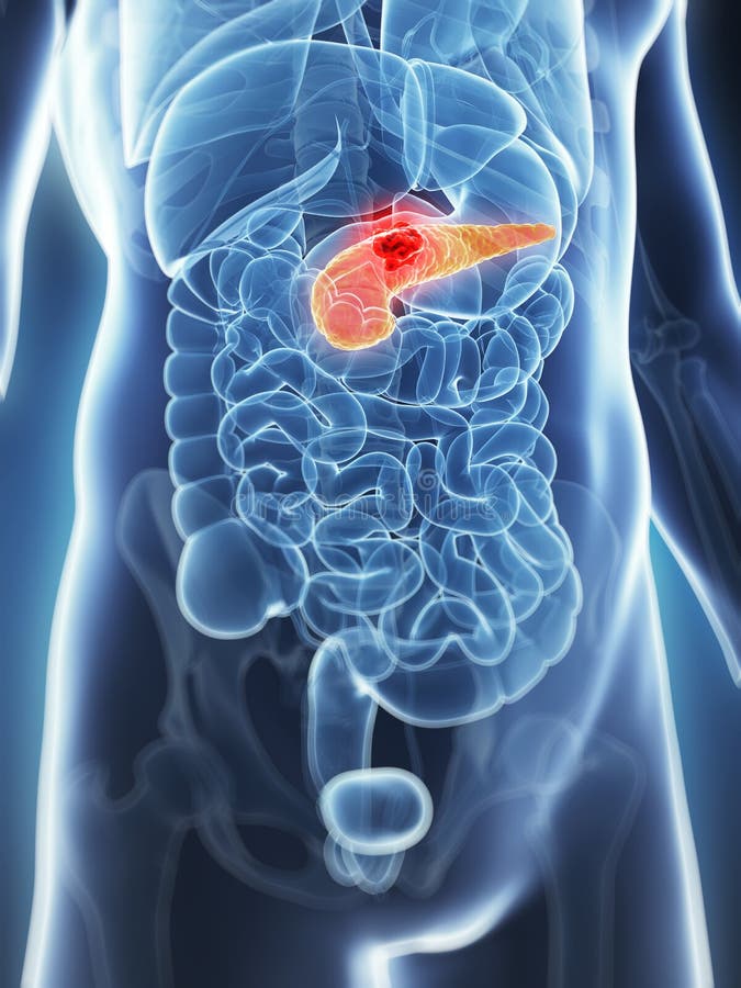 Male Pancreas Cancer Royalty Free Stock Photo Image
