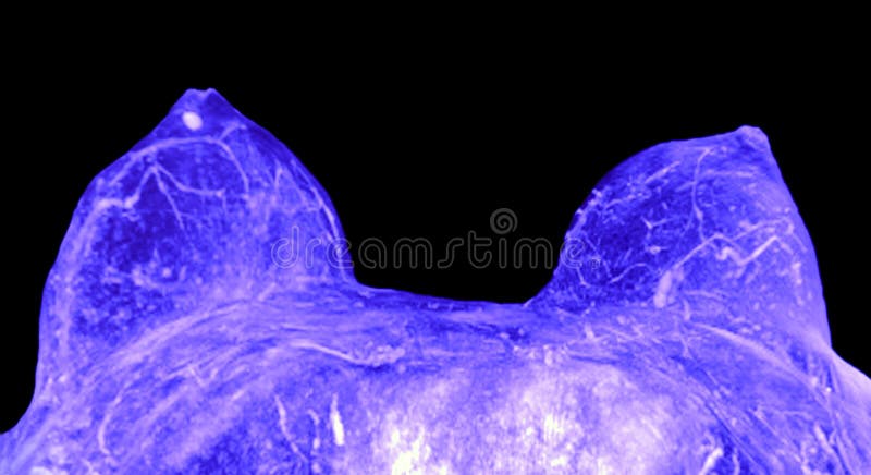 mammographymr fotografering för bildbyråer mammographymr fotografering för bildbyråer