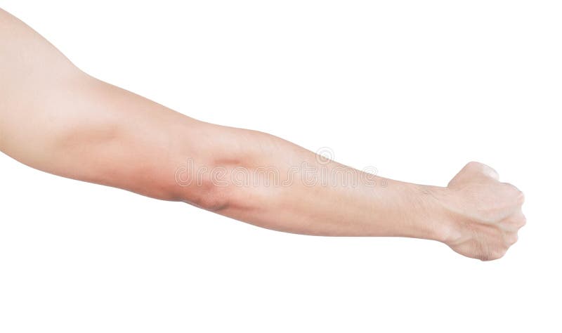 Man Arm with Blood Veins on White Background, Health Care and Medical Concept Stock Photo - Image of strength, pain: 145865322 Man Arm with Blood Veins on White Background, Health Care and Medical Concept Stock Photo - Image of strength, pain: 145865322