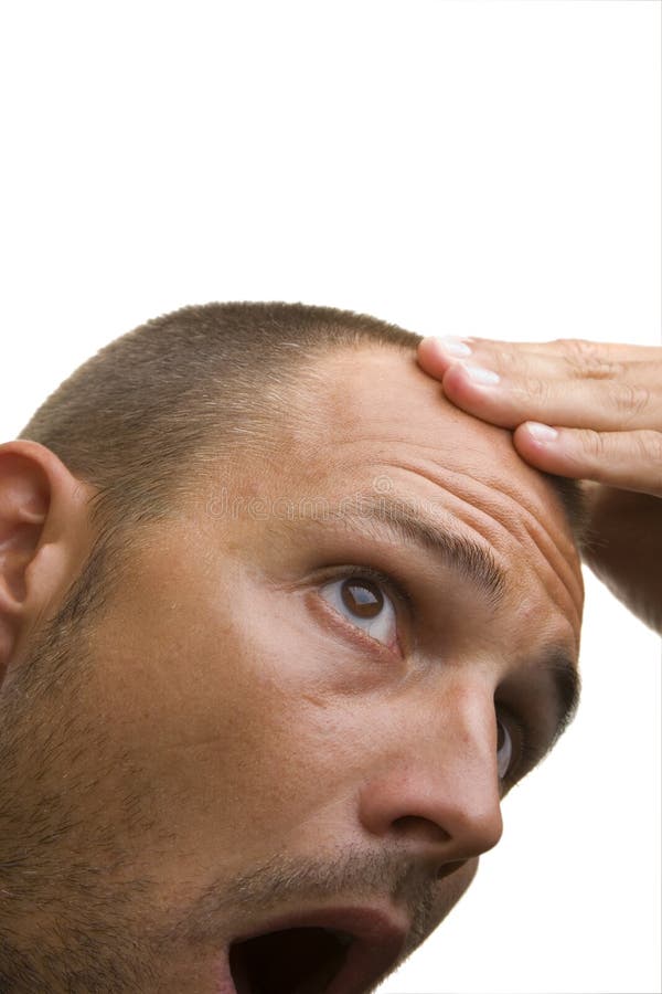 Man and Baldspot royalty free stock photo Man and Baldspot royalty free stock photo