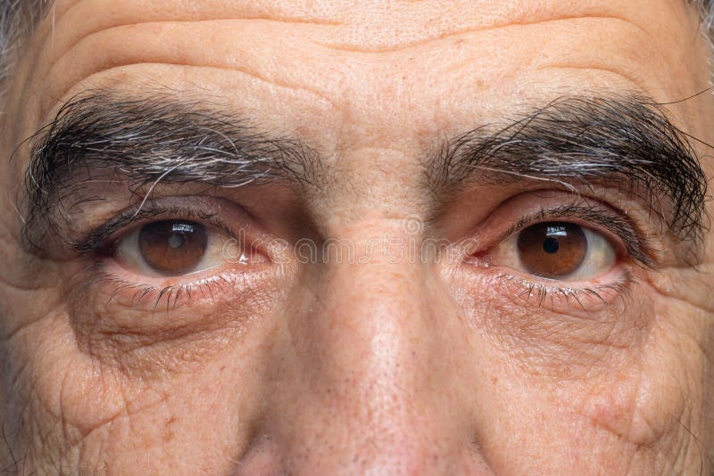 Conjunctivitis symptoms, and 10 most effective tips to manage pink eye in rainy