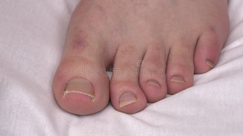world longest toenails