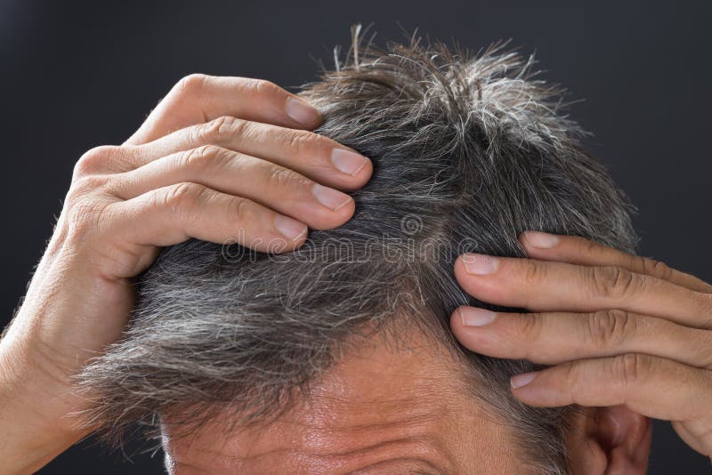 Man Examining His White Hair