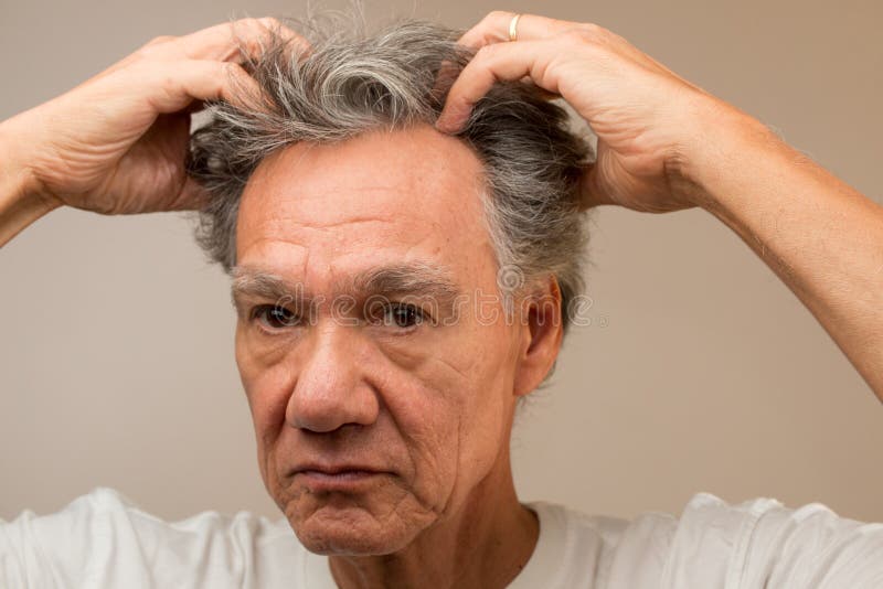 Man Giving Himself a Self-Head Massage Stock Image - Image of looking,  face: 193886223