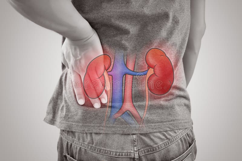 Man kidney failure, Renal failure against gray background, illustration