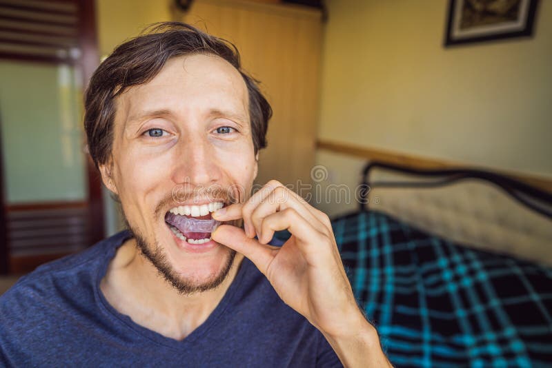 Man placing a bite plate in his mouth to protect his teeth at night from grinding caused by bruxism, close up view of