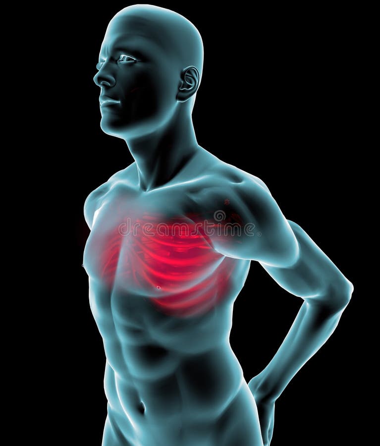 Human Xray with Pain in the Rib Cage Stock Illustration Illustration