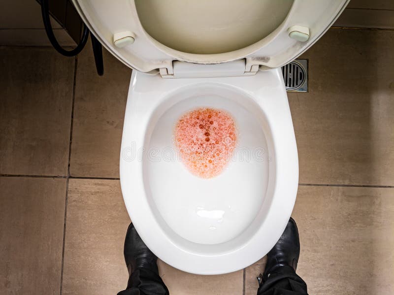 Bloody Urine Toilet Stock Photos Free & RoyaltyFree Stock Photos