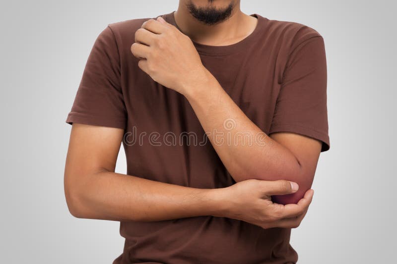 Elbow pain. stock image. Image of symptoms, redness 269477349