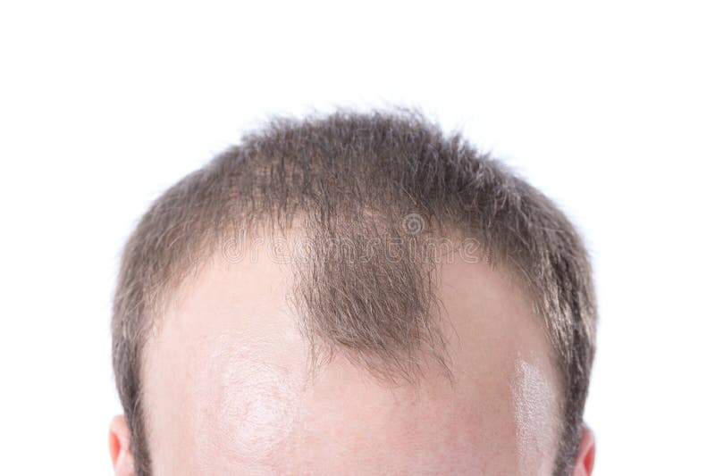 592 Brown Hairline Stock Photos - Free & Royalty-Free Stock Photos from Dreamstime 592 Brown Hairline Stock Photos - Free & Royalty-Free Stock Photos from Dreamstime
