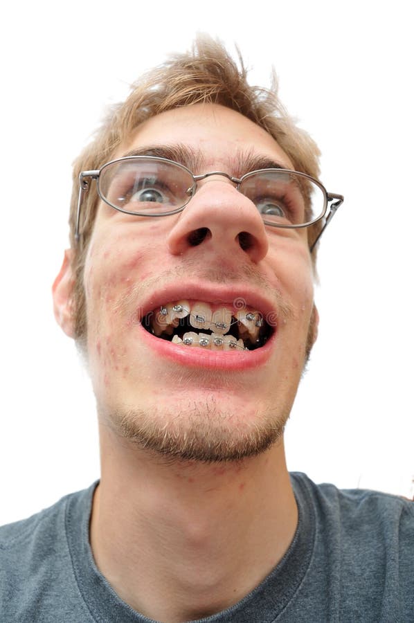 Ugly Man Smiling with Crooked Yellow Teeth Stock Photo Image of