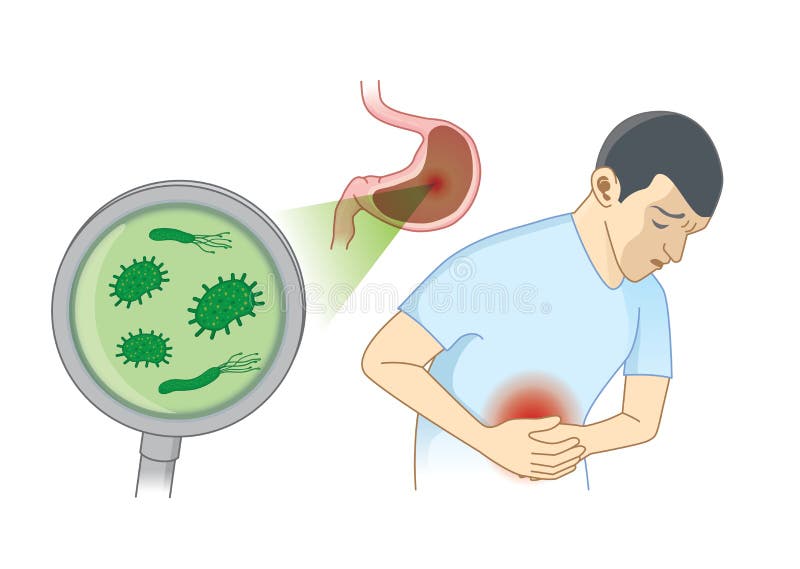 Bacteria en el estomago tratamiento