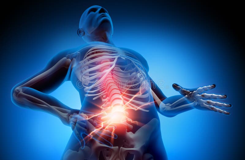 Man suffering with strong pain in spine stock illustration Man suffering with strong pain in spine stock illustration