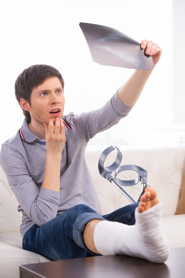 Mann mit einem gebrochenen Bein lizenzfreies stockbild Mann mit einem gebrochenen Bein lizenzfreies stockbild