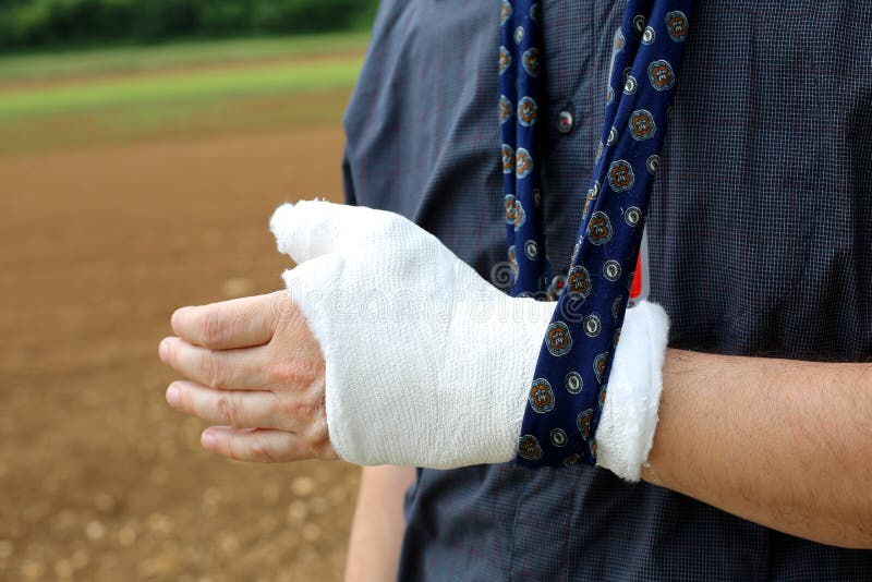 Mano della persona danneggiata dopo la frattura dell'osso fotografia stock libera da diritti Mano della persona danneggiata dopo la frattura dell'osso fotografia stock libera da diritti