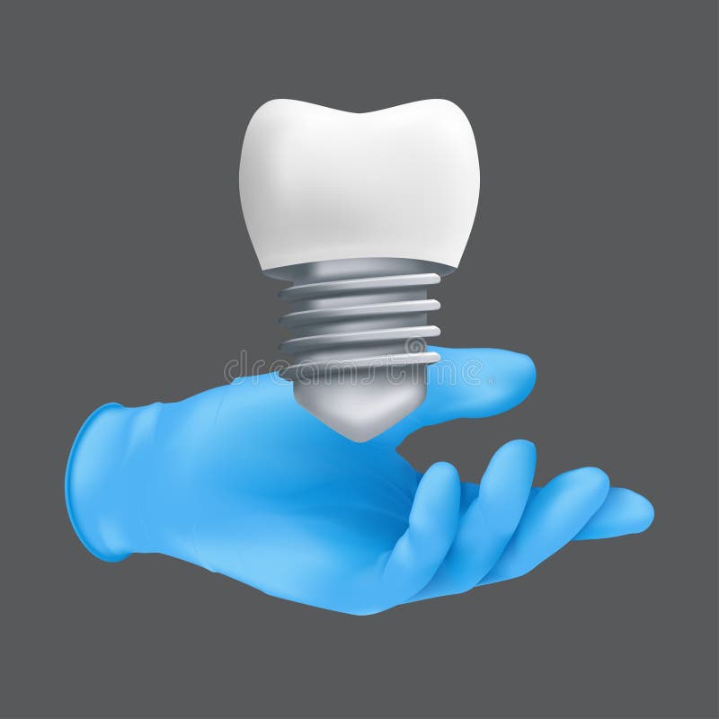 Dentist hand wearing blue protective surgical glove holding a ceramic model of the tooth. 3d realistic vector illustration of dental implants concept isolated on a grey background. Dentist hand wearing blue protective surgical glove holding a ceramic model of the tooth. 3d realistic vector illustration of dental implants concept isolated on a grey background