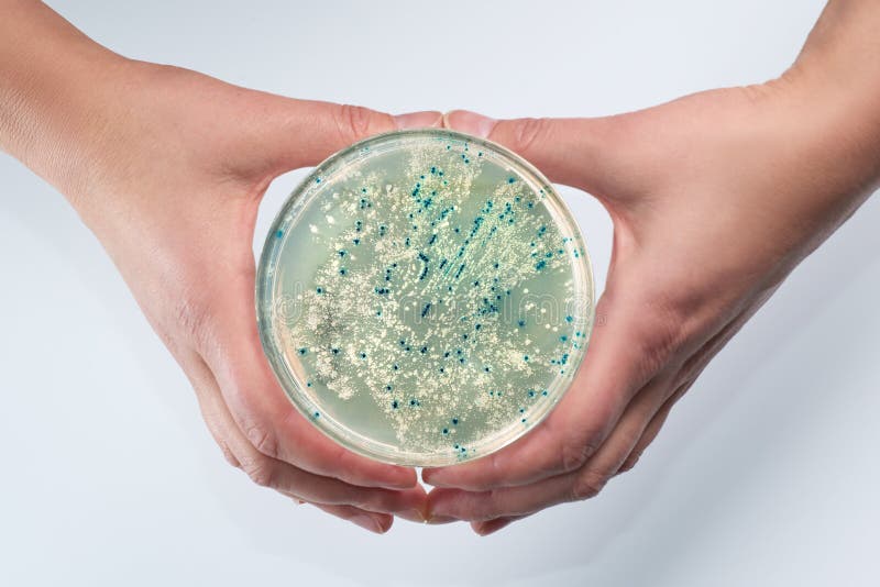 Manos femeninas que llevan a cabo una placa de Petri con las colonias bacterianas en aga