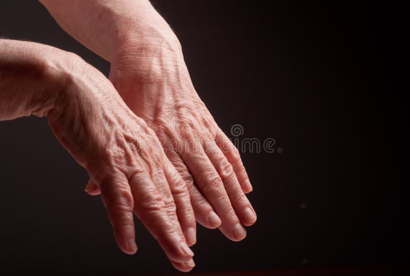 reumatism autoimun semnele și tratamentul artrozei gleznei