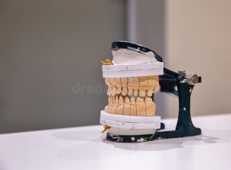Manufacturing of a Human Permanent Ceramicmetal Dental Prosthesis on