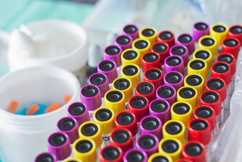 Many Test Tube Setup at Automatic Sample Concentrator Machine Device