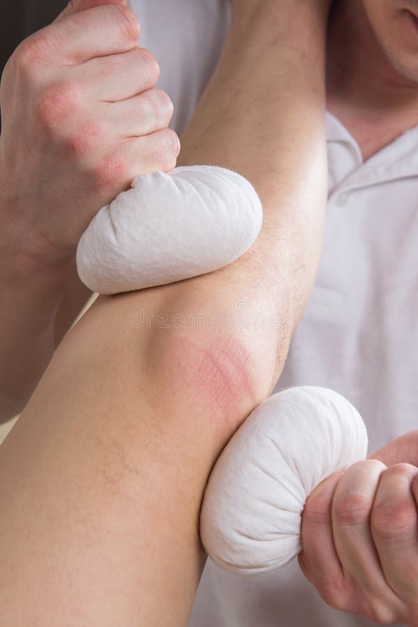 Massage med det växt- påsepatientknäet arkivfoto Massage med det växt- påsepatientknäet arkivfoto
