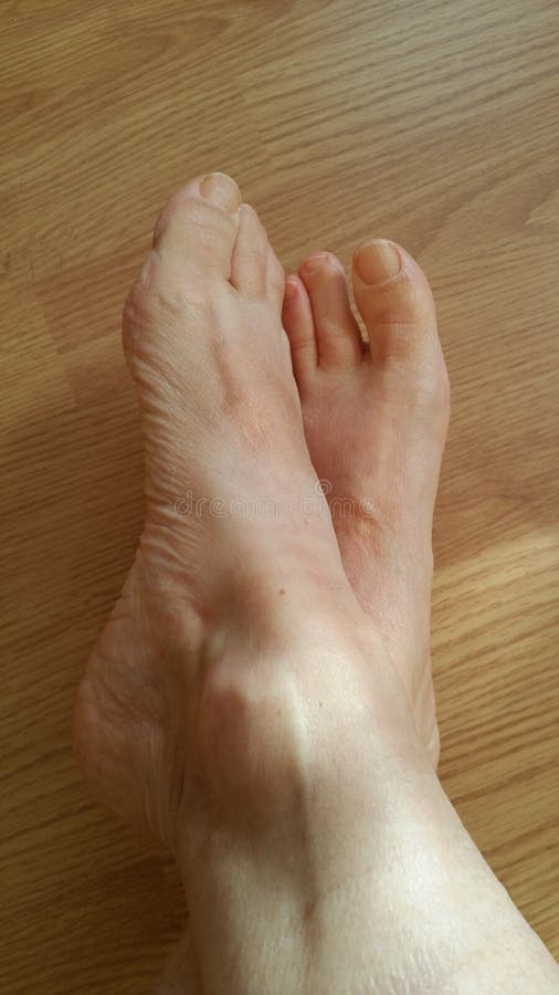 Mature Women Feet Pics