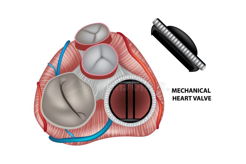 Mechanical artificial valve stock illustration Mechanical artificial valve stock illustration