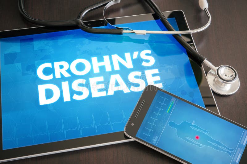 MED do diagnóstico da doença de Crohn (doença gastrintestinal relativa) ilustração royalty free MED do diagnóstico da doença de Crohn (doença gastrintestinal relativa) ilustração royalty free