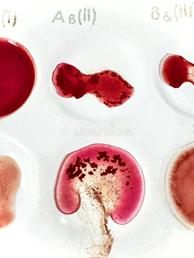 medical-agglutination-reaction-to-determine-blood-group-compatibility-stock-illustration