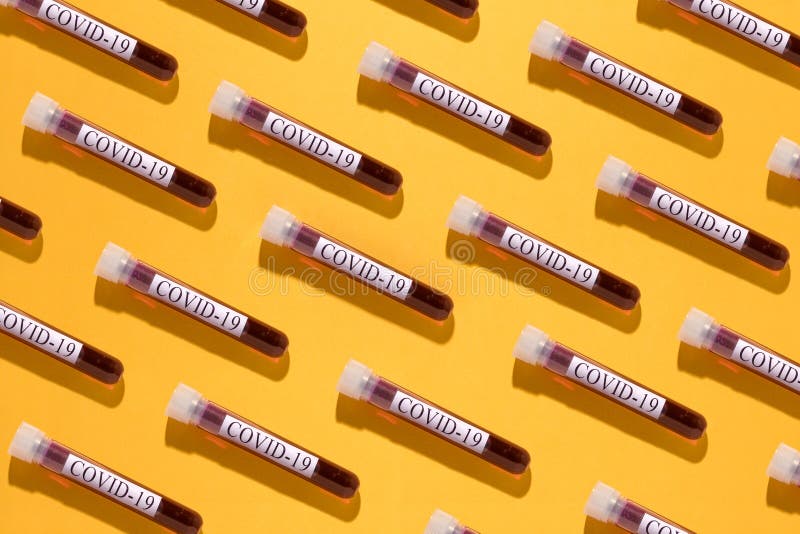 Download Blood In Test Tubes On Yellow Background Stock Photo Image Of Biological Creative 176359496 PSD Mockup Templates