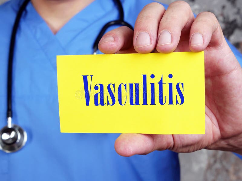 Medical Concept about Vasculitis with Phrase on the Sheet Stock Photo Image of supplement