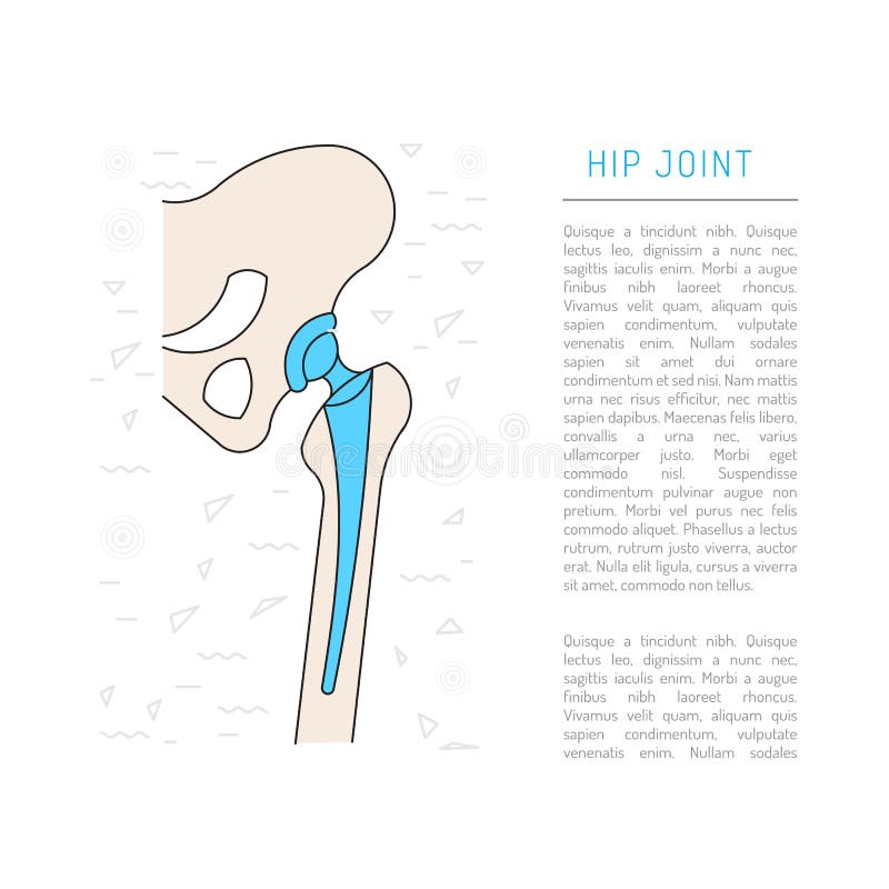 Medical illustration hip joint vector illustration Medical illustration hip joint vector illustration