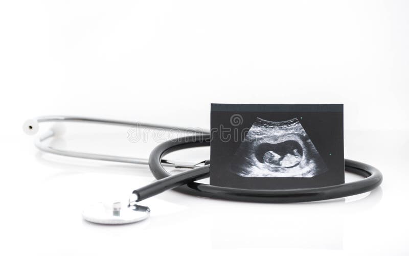 Medical images collage of ultrasound during woman pregnancy showing fetus in third month and stetoscope on white background royalty free stock photography Medical images collage of ultrasound during woman pregnancy showing fetus in third month and stetoscope on white background royalty free stock photography