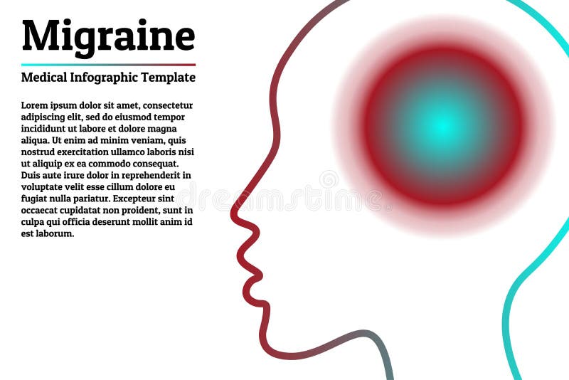 Therapy Migraine Stock Illustrations 1113 Therapy Migraine Stock