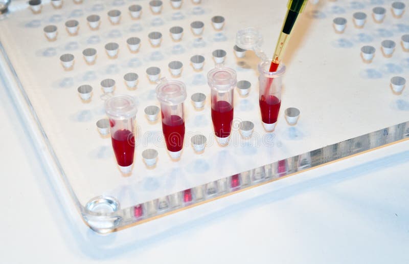 In medical laboratories studied blood. stock photo In medical laboratories studied blood. stock photo