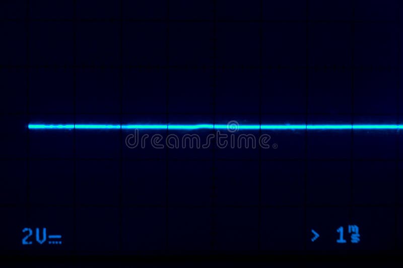 Medical Oscilloscope at the finality of death