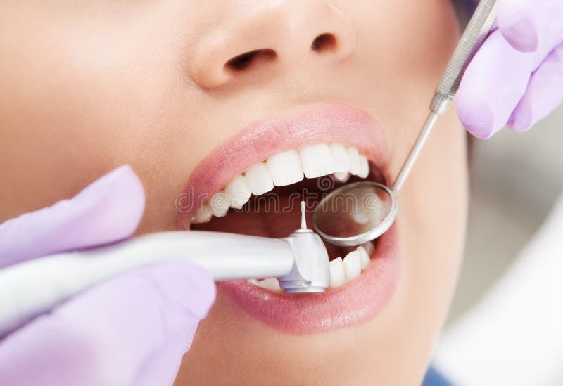 Close-up of human teeth being drilled by dentist. Close-up of human teeth being drilled by dentist