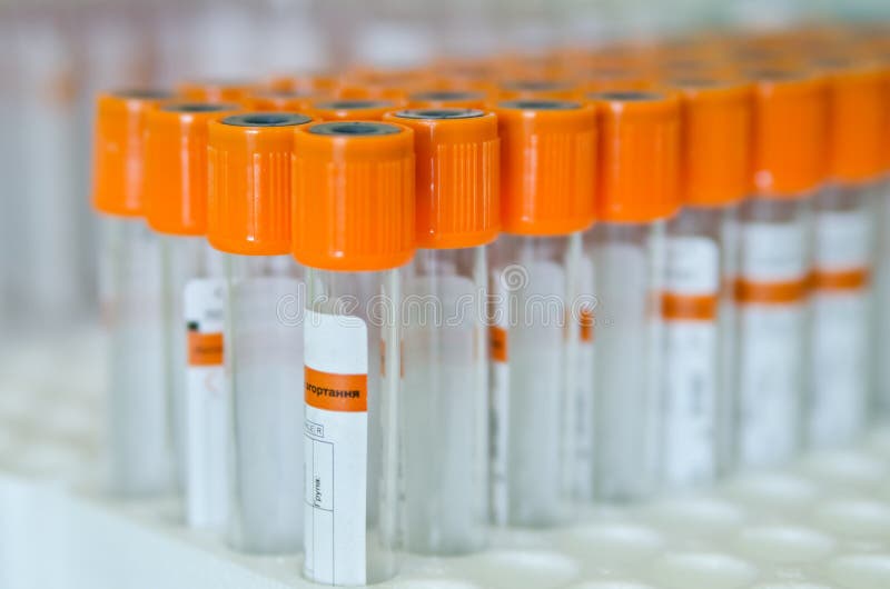 Medical Test Tubes with Orange Lid Stock Image Image of medical, tube