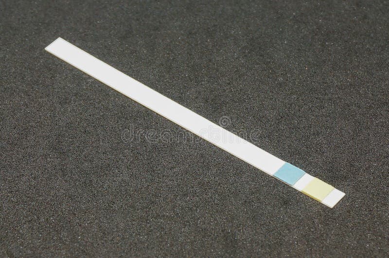 Medical urine dipstick stock image. Image of close, color 87513801