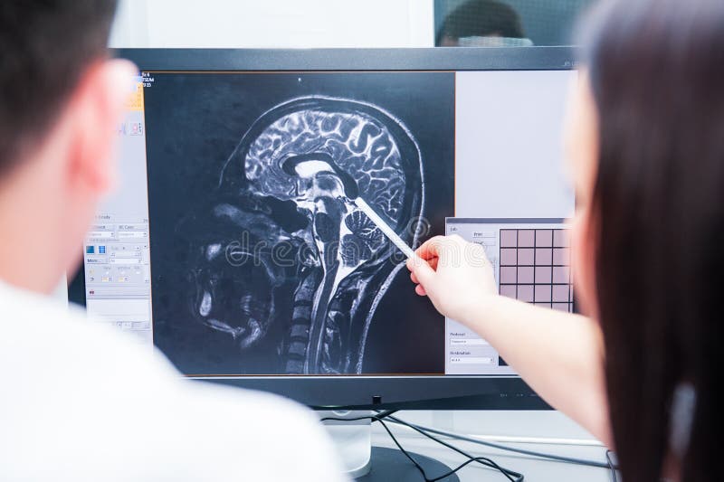Medici considerano e discutono il RMI a risonanza magnetica di immagine del cervello Vista posteriore, fuoco selettivo