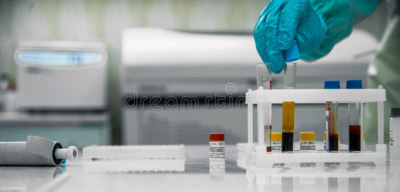 Medicinsk laboratorieutrustning Blodtest Medicinskt begrepp royaltyfri foto Medicinsk laboratorieutrustning Blodtest Medicinskt begrepp royaltyfri foto