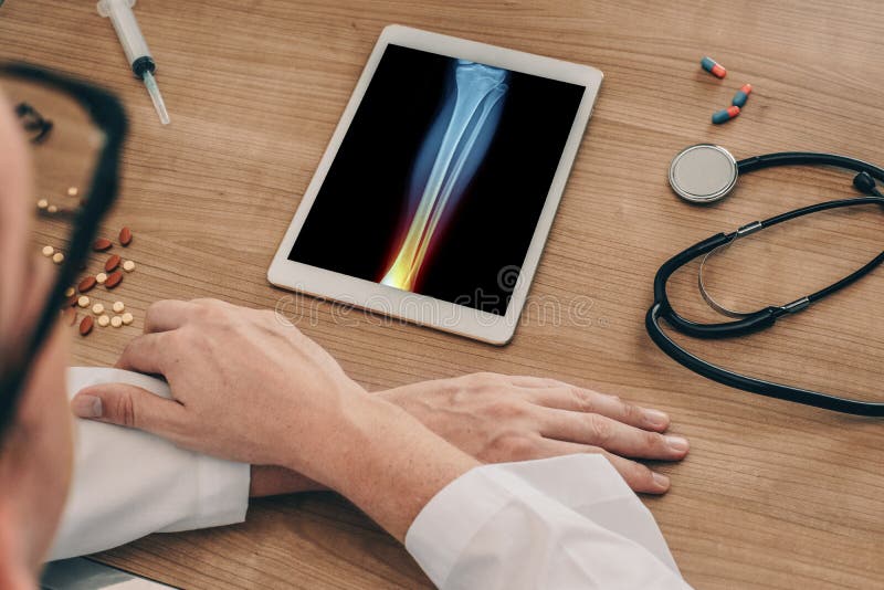 Medico che guarda una compressa digitale con i raggi x della gamba con dolore nella caviglia fotografie stock Medico che guarda una compressa digitale con i raggi x della gamba con dolore nella caviglia fotografie stock